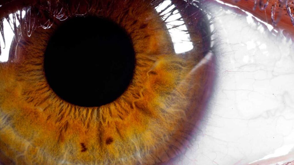 Rodzaj wad wzroku - zdjęcie starczości